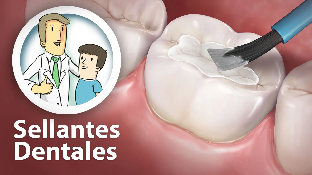 Sellantes Dentist Elk Grove Ca Dental Spanish Education Library