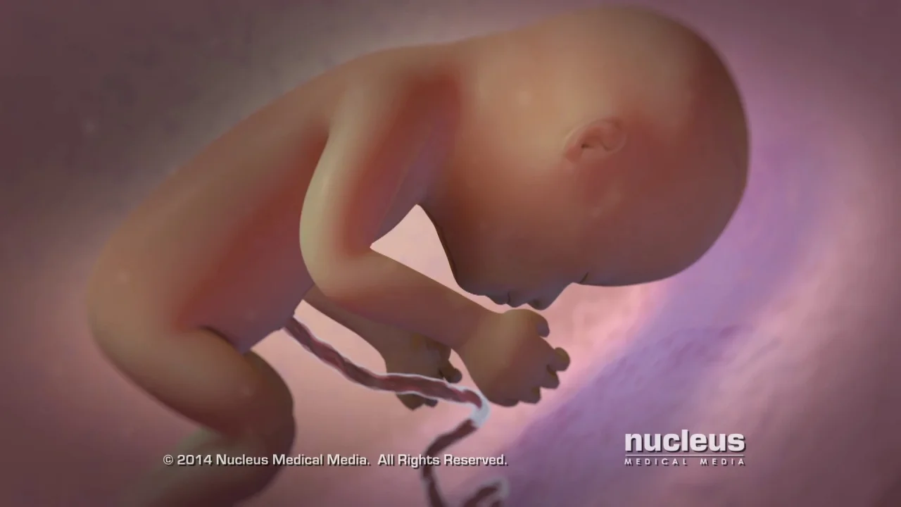 Twin Twin Transfusion Syndrome Ttts Children S Wisconsin Twin Twin Transfusion Syndrome Ttts Children S Wisconsin