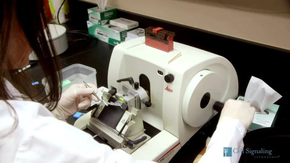 免疫組織化学染色 Ihc の概要