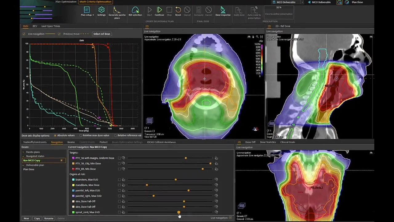 Tomotherapy In Raystation Raysearch Laboratories